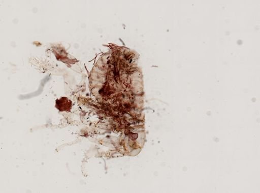 Pulex irritans