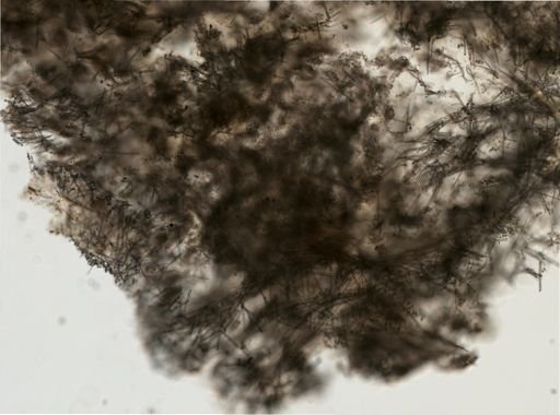 Lissodendoryx cf. noxiosa
