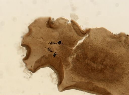 Pleioplana atomata