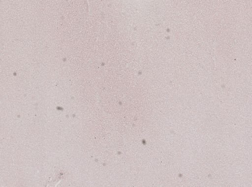 Trypanosoma equinum