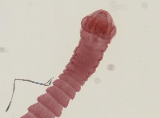 Dipylidium caninum