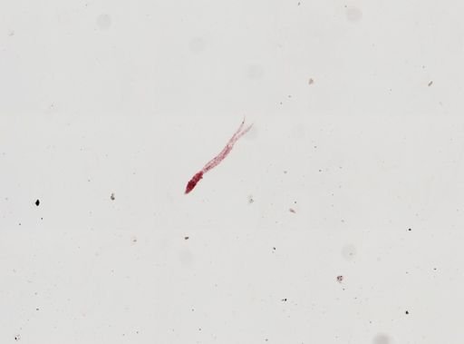 Cercaria gracillima?