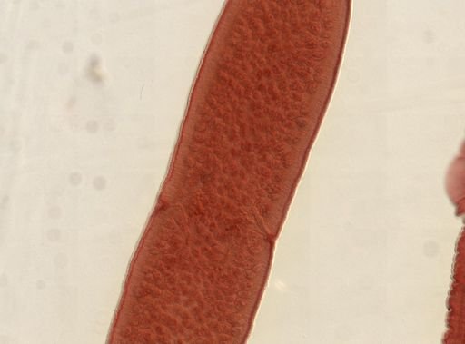 Dipylidium caninum
