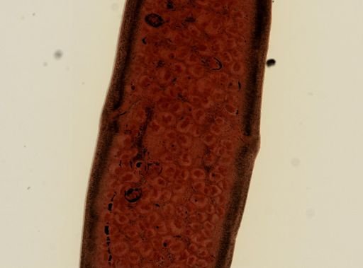 Dipylidium caninum