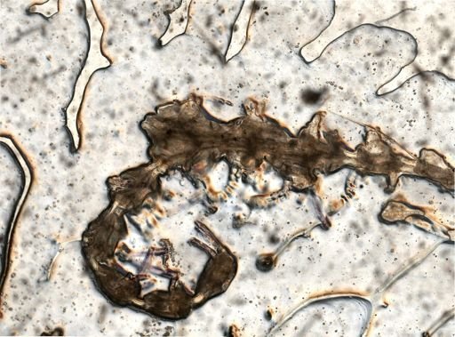Bryozoa