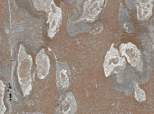 Taenia crassicollis
