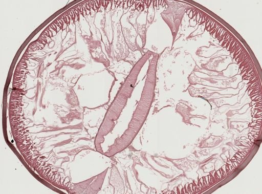 Ascaris lumbricoides
