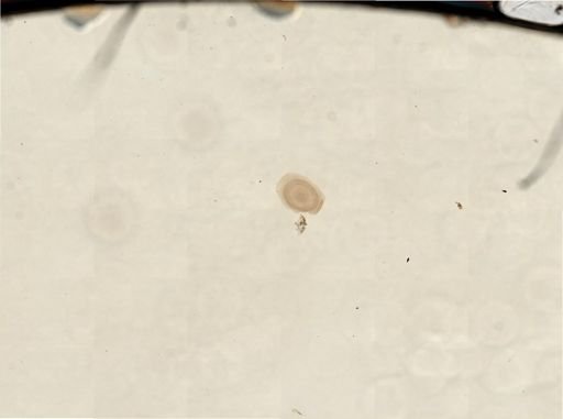 Plumatella repens