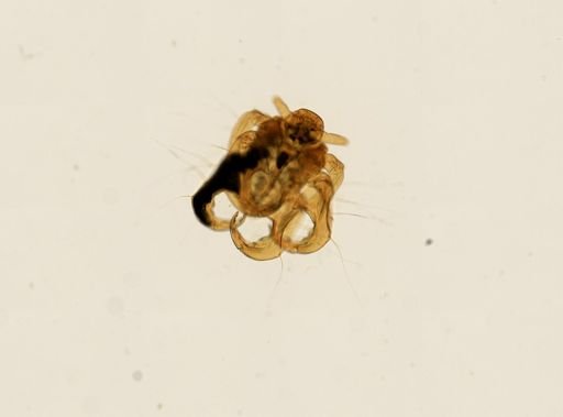Pthirus pubis