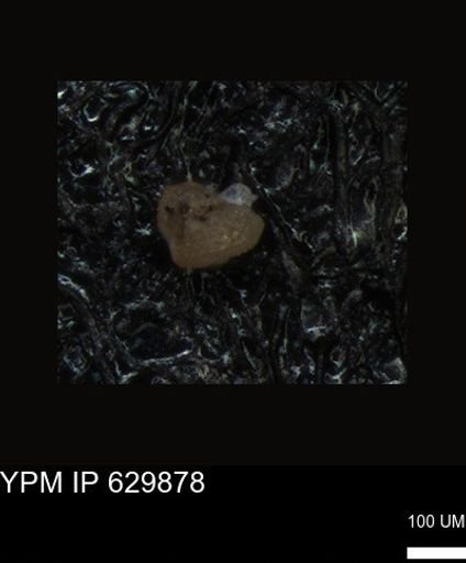 undet. Foraminiferida