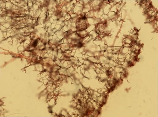 Haliclona oculata
