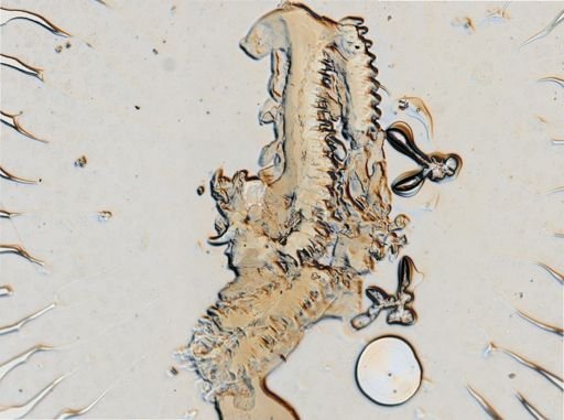 Onchidoris muricata