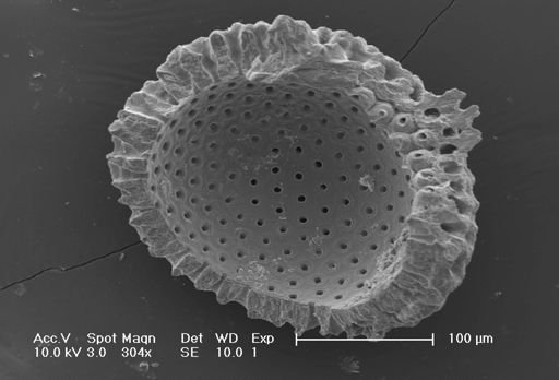 Globigerinoides ruber