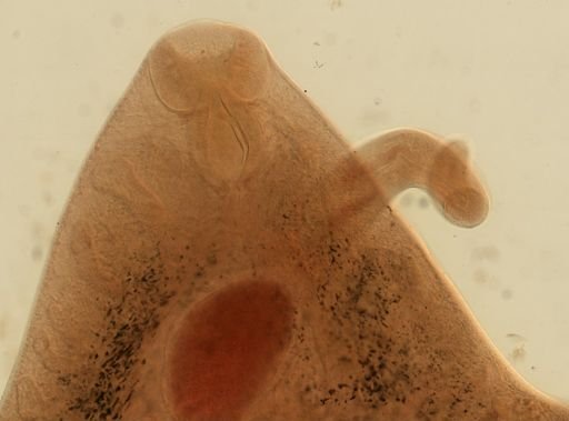 Fasciola hepatica