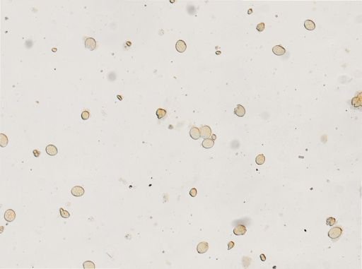 Diphyllobothrium latum