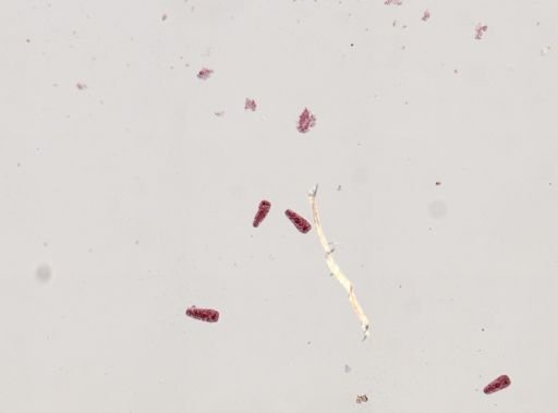 Fasciola hepatica