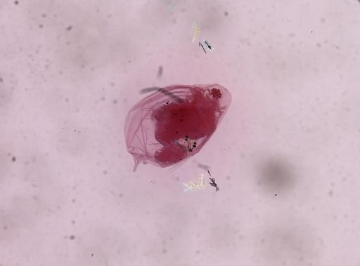 Cladocera