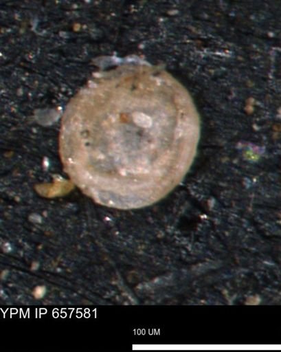 Glomospira?