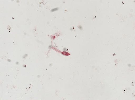 Cercaria gracillima