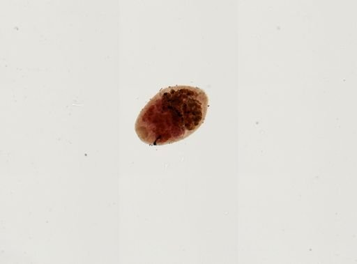 Prosthodendrium naviculum
