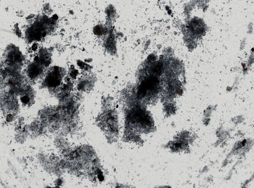 Entamoeba histolytica