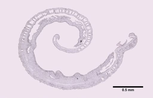Distomum haematobium