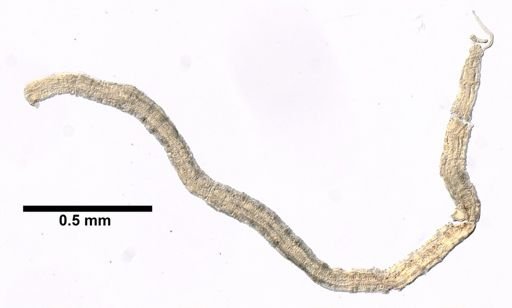 Protodrilus adhaerens