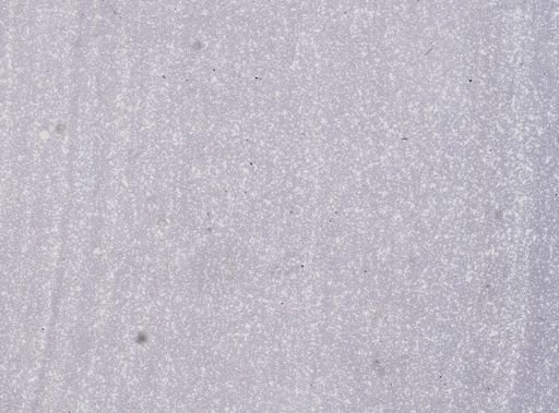 Trypanosoma equiperdum