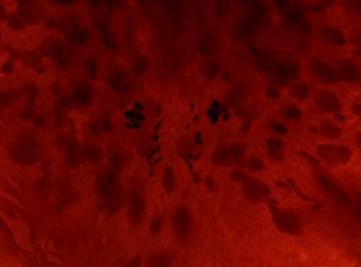 Pleioplana atomata