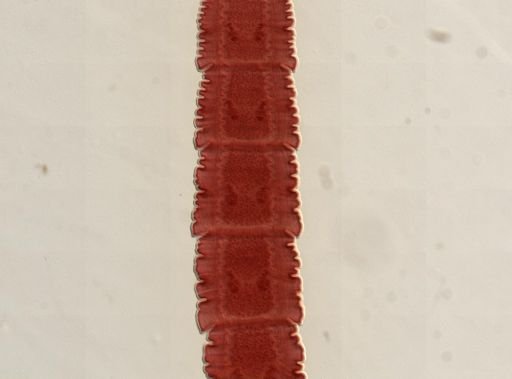 Dipylidium caninum