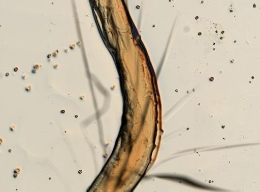 Necator americanus