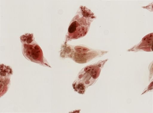 Epiphanes senta