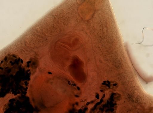 Fasciola hepatica