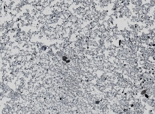 Giardia lamblia