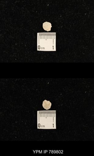 undet. Brachiopoda
