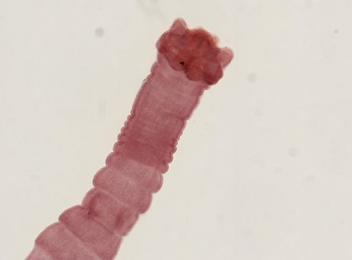 Dipylidium caninum