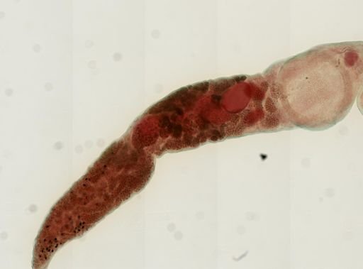 Gorgoderina attenuata