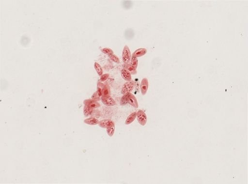 Paramecium calkinsi