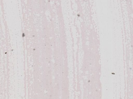 Trypanosoma equinum