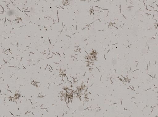 Ophlitaspongia papilla