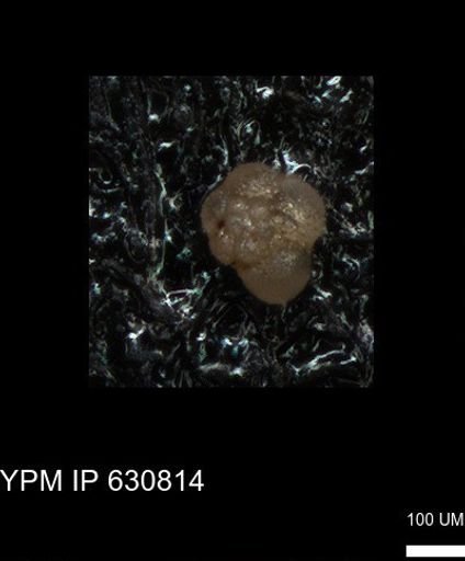 undet. Rugoglobigerinidae