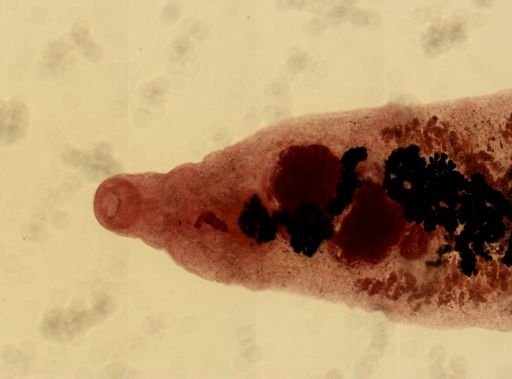Dicrocoelium dendriticum