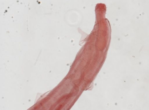 Macracanthorhynchus ingens