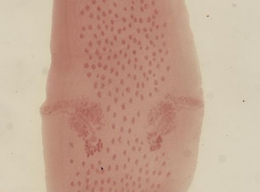 Dipylidium caninum