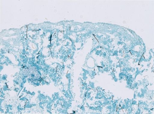 Ectyoplasia ferox