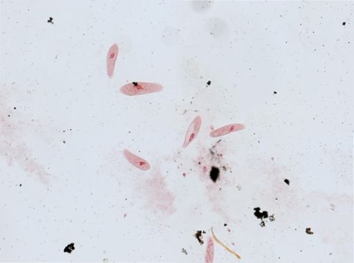 Paramecium aurelia