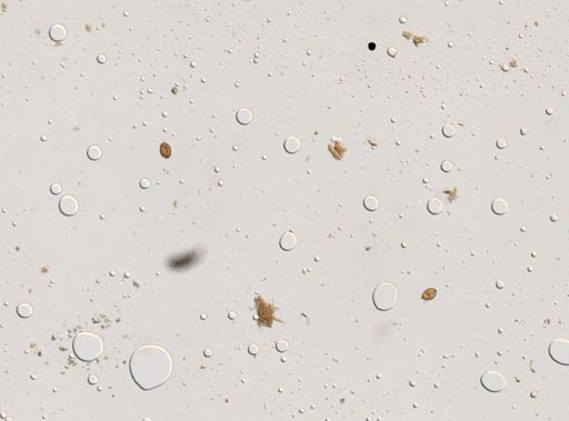 Diphyllobothrium canis