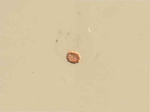 Branchiostoma