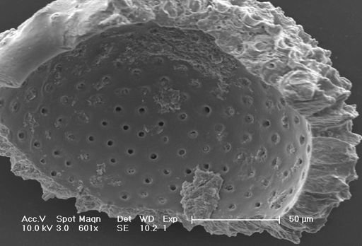 Globigerinoides ruber