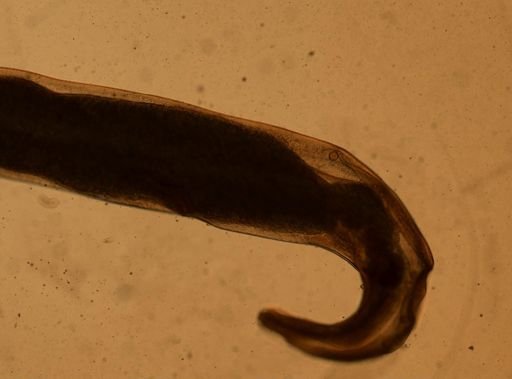 Enterobius vermicularis